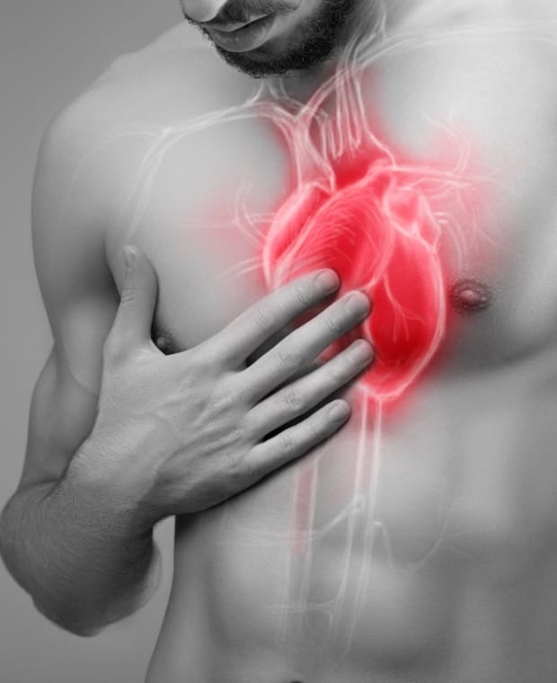 冠動脈バイパス手術