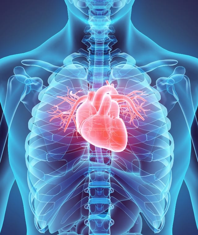 大動脈瘤・解離