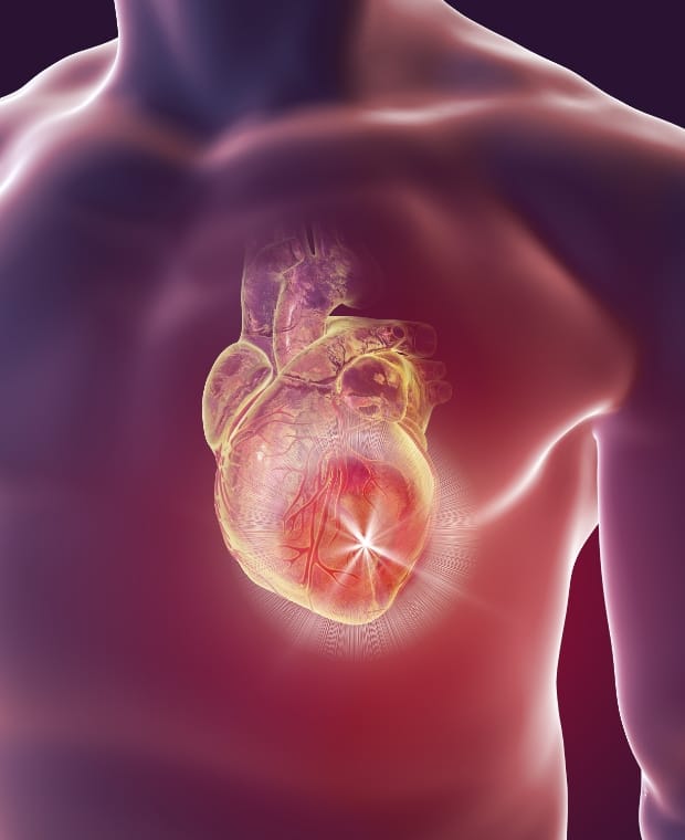 低侵襲治療(MICS、TAVIなど)